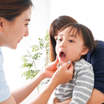 乳歯・永久歯のむし歯