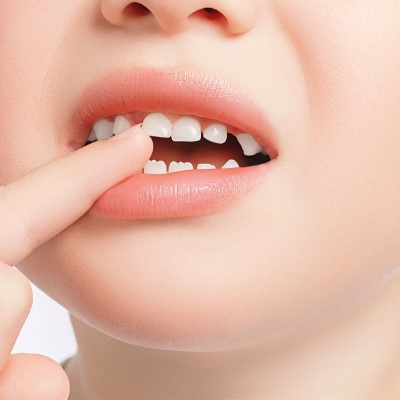 乳歯が抜けない