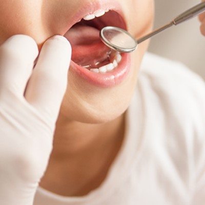 乳歯の後ろに永久歯が生えてきた